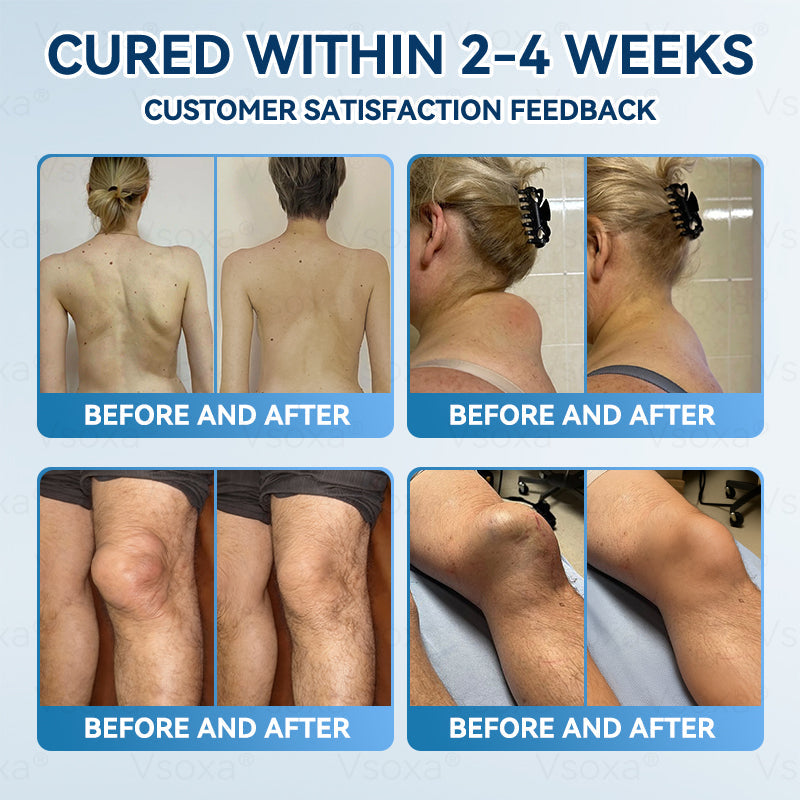 Regain Flexible Joints in Just 2 Weeks! 💪 𝑉𝑠𝑜𝑥𝑎® 𝐵&𝑇 (BPC-157 & TB-500) Nano Microneedle Patch 👨‍🔬 Dual-Peptide Pain Relief & Joint Repair | Repairs Arthritis, Rheumatism, Neuropathy & Sports Injuries | Fast-Acting · Non-Invasive · FDA-Grade Purity