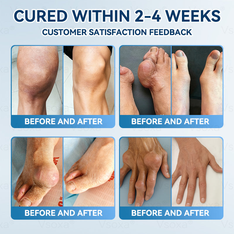 Regain Flexible Joints in Just 2 Weeks! 💪 𝑉𝑠𝑜𝑥𝑎® 𝐵&𝑇 (BPC-157 & TB-500) Nano Microneedle Patch 👨‍🔬 Dual-Peptide Pain Relief & Joint Repair | Repairs Arthritis, Rheumatism, Neuropathy & Sports Injuries | Fast-Acting · Non-Invasive · FDA-Grade Purity