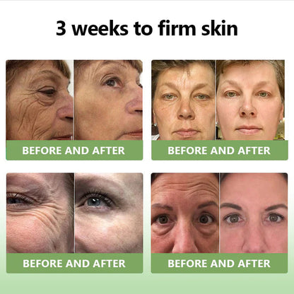 STDEI™  𝑳𝒖𝒙𝒖𝒓𝒊𝒐𝒖𝒔 𝑪𝒐𝒍𝒍𝒂𝒈𝒆𝒏 𝑭𝒊𝒓𝒎𝒊𝒏𝒈 𝑪𝒓𝒆𝒂𝒎💋(🔥70% Off for a Limited Time!)🔥