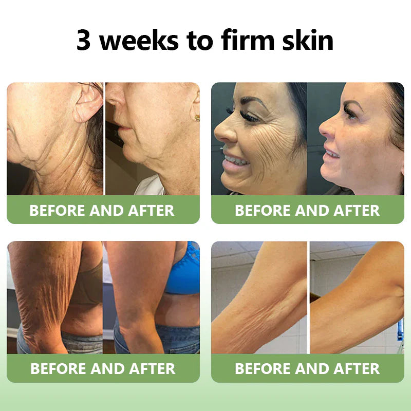 STDEI™  𝑳𝒖𝒙𝒖𝒓𝒊𝒐𝒖𝒔 𝑪𝒐𝒍𝒍𝒂𝒈𝒆𝒏 𝑭𝒊𝒓𝒎𝒊𝒏𝒈 𝑪𝒓𝒆𝒂𝒎💋(🔥70% Off for a Limited Time!)🔥