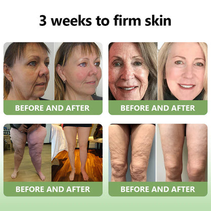 STDEI™  𝑳𝒖𝒙𝒖𝒓𝒊𝒐𝒖𝒔 𝑪𝒐𝒍𝒍𝒂𝒈𝒆𝒏 𝑭𝒊𝒓𝒎𝒊𝒏𝒈 𝑪𝒓𝒆𝒂𝒎💋(🔥70% Off for a Limited Time!)🔥