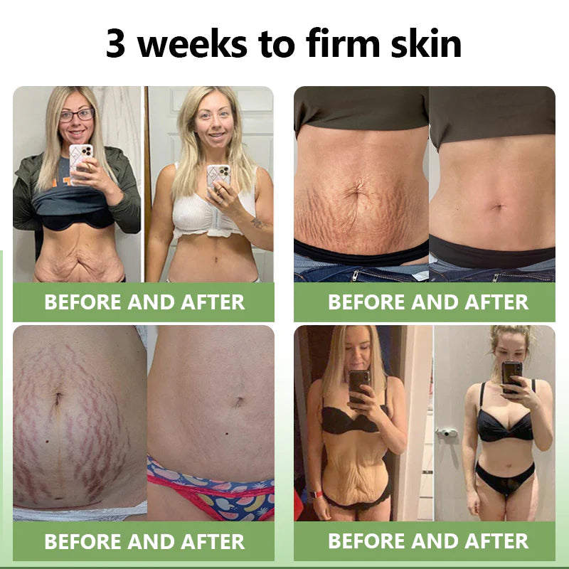 STDEI™  𝑳𝒖𝒙𝒖𝒓𝒊𝒐𝒖𝒔 𝑪𝒐𝒍𝒍𝒂𝒈𝒆𝒏 𝑭𝒊𝒓𝒎𝒊𝒏𝒈 𝑪𝒓𝒆𝒂𝒎💋(🔥70% Off for a Limited Time!)🔥