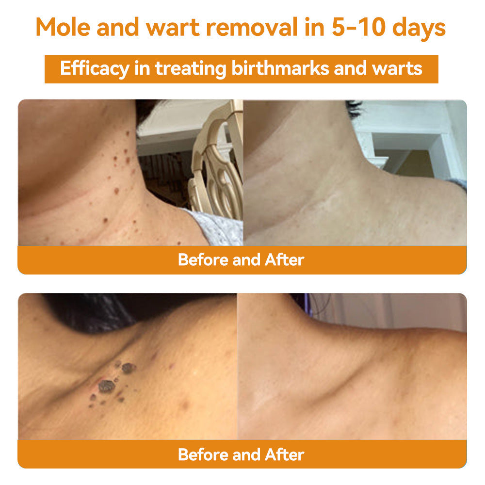 Turonu™ 🌻𝑩𝒆𝒆 𝑽𝒆𝒏𝒐𝒎 𝑺𝒌𝒊𝒏 𝑻𝒓𝒆𝒂𝒕𝒎𝒆𝒏𝒕 𝑪𝒓𝒆𝒂𝒎（𝐴𝐴𝐷 𝑅𝑒𝑐𝑜𝑚𝑚𝑒𝑛𝑑𝑒𝑑） (🔥𝑳𝒂𝒔𝒕 𝒅𝒂𝒚 𝒑𝒓𝒐𝒎𝒐𝒕𝒊𝒐𝒏 80% 𝒐𝒇𝒇)