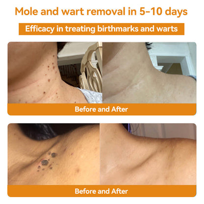 Turonu™ 🌻𝑩𝒆𝒆 𝑽𝒆𝒏𝒐𝒎 𝑺𝒌𝒊𝒏 𝑻𝒓𝒆𝒂𝒕𝒎𝒆𝒏𝒕 𝑪𝒓𝒆𝒂𝒎（𝐴𝐴𝐷 𝑅𝑒𝑐𝑜𝑚𝑚𝑒𝑛𝑑𝑒𝑑） (🔥𝑳𝒂𝒔𝒕 𝒅𝒂𝒚 𝒑𝒓𝒐𝒎𝒐𝒕𝒊𝒐𝒏 80% 𝒐𝒇𝒇)