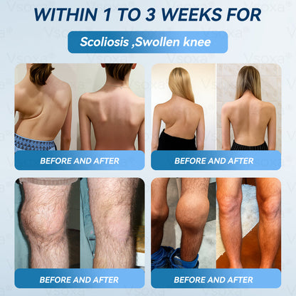 Regain Flexible Joints in Just 2 Weeks! 💪 𝑉𝑠𝑜𝑥𝑎® 𝐵&𝑇 (BPC-157 & TB-500) Nano Microneedle Patch 👨‍🔬 Dual-Peptide Pain Relief & Joint Repair | Repairs Arthritis, Rheumatism, Neuropathy & Sports Injuries | Fast-Acting · Non-Invasive · FDA-Grade Purity