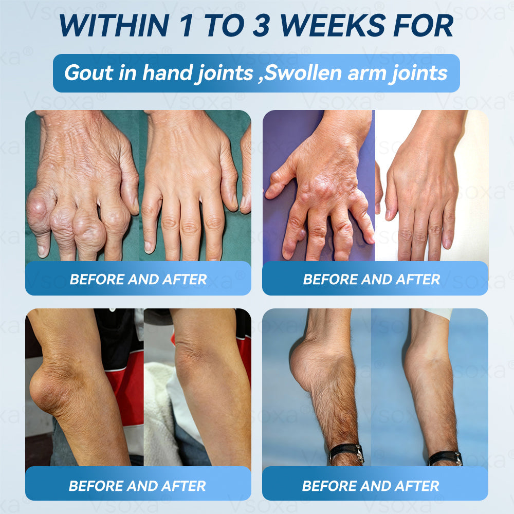 Regain Flexible Joints in Just 2 Weeks! 💪 𝑉𝑠𝑜𝑥𝑎® 𝐵&𝑇 (BPC-157 & TB-500) Nano Microneedle Patch 👨‍🔬 Dual-Peptide Pain Relief & Joint Repair | Repairs Arthritis, Rheumatism, Neuropathy & Sports Injuries | Fast-Acting · Non-Invasive · FDA-Grade Purity