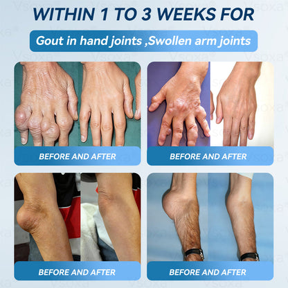 Regain Flexible Joints in Just 2 Weeks! 💪 𝑉𝑠𝑜𝑥𝑎® 𝐵&𝑇 (BPC-157 & TB-500) Nano Microneedle Patch 👨‍🔬 Dual-Peptide Pain Relief & Joint Repair | Repairs Arthritis, Rheumatism, Neuropathy & Sports Injuries | Fast-Acting · Non-Invasive · FDA-Grade Purity