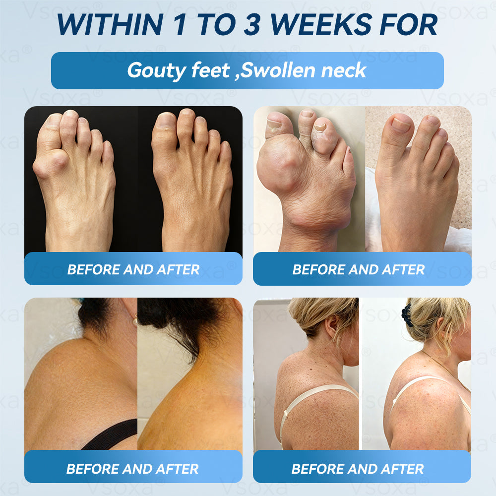 Regain Flexible Joints in Just 2 Weeks! 💪 𝑉𝑠𝑜𝑥𝑎® 𝐵&𝑇 (BPC-157 & TB-500) Nano Microneedle Patch 👨‍🔬 Dual-Peptide Pain Relief & Joint Repair | Repairs Arthritis, Rheumatism, Neuropathy & Sports Injuries | Fast-Acting · Non-Invasive · FDA-Grade Purity